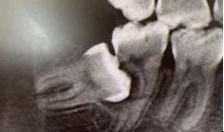 智齿在线观看,揭秘口腔健康与智慧生活新篇章